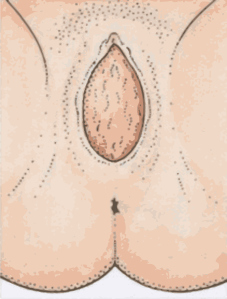 Medical Illustration by Christien Mozzarti